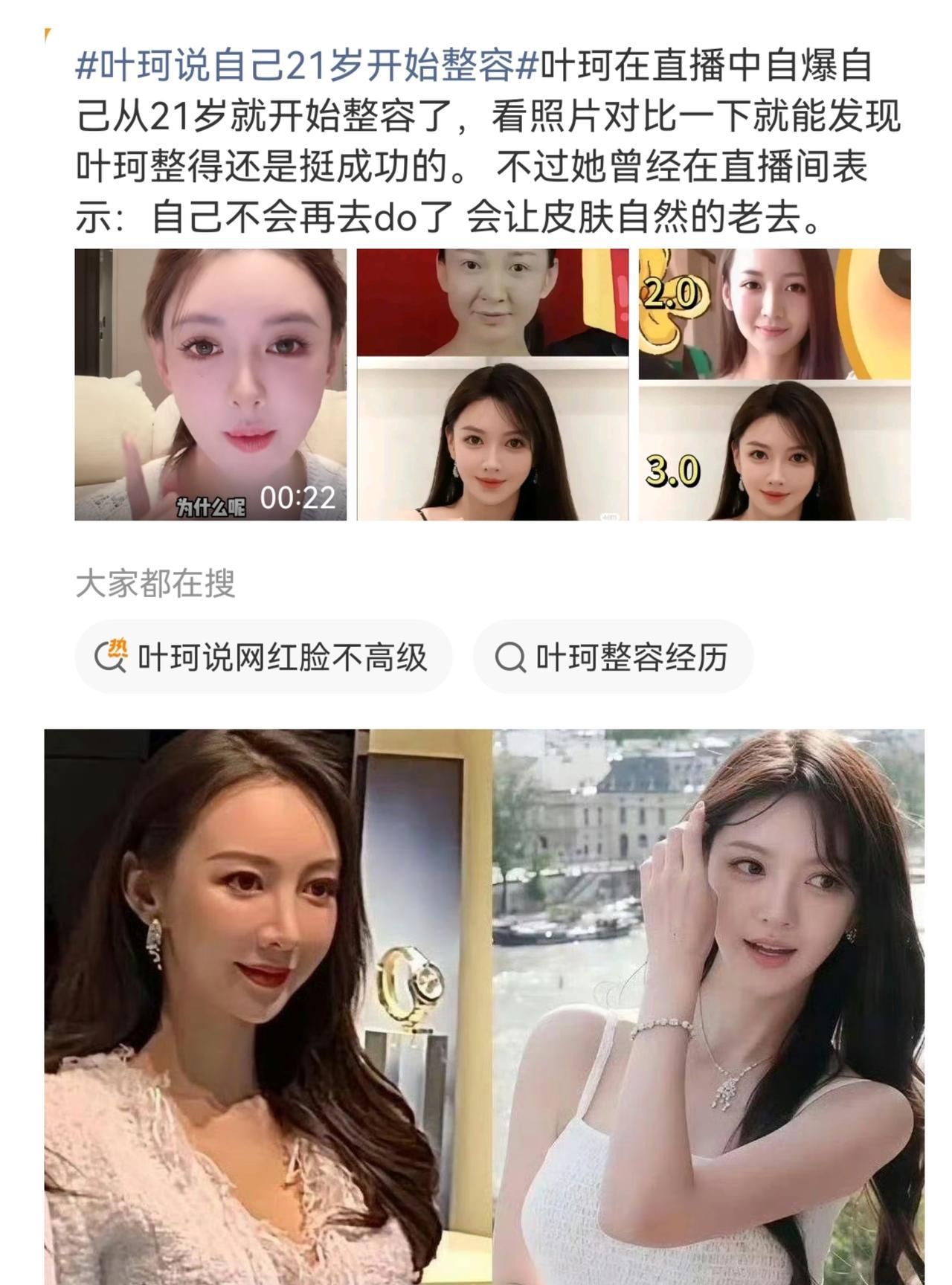 离开黄晓明的叶珂简直是拼到极致了，啥都往外抖，连自己从21岁起就整容这等私密事都