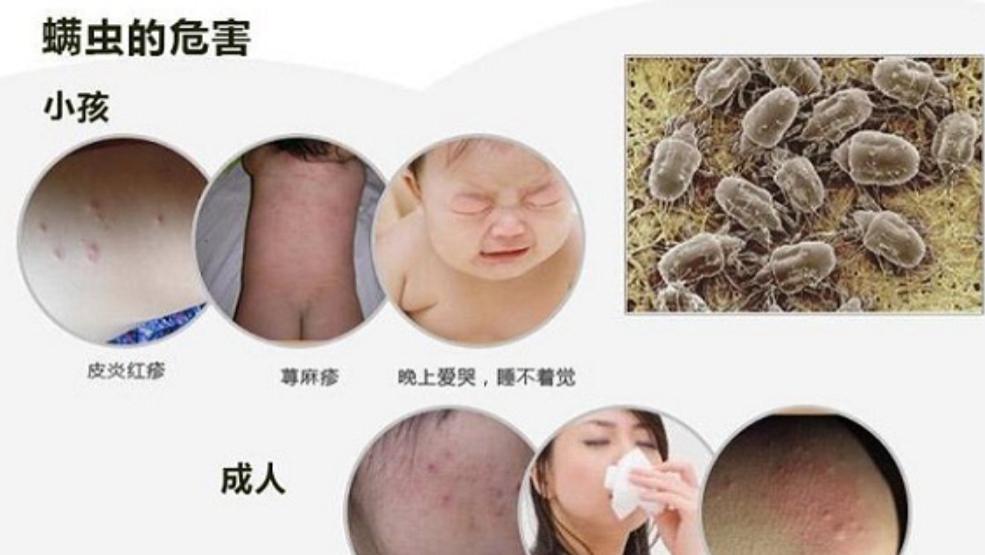 床上用的除螨仪到底有没有用？分享除螨仪排行榜品牌前十名！