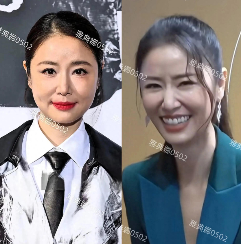 今年巴黎时装周时期，林心如因为脸又圆又肿被媒体狠嘲，半个月过去了，林心如接受采访