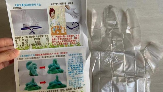 初二男孩自研化学实验被炸伤后续：手部截肢、右眼失明，已募捐！