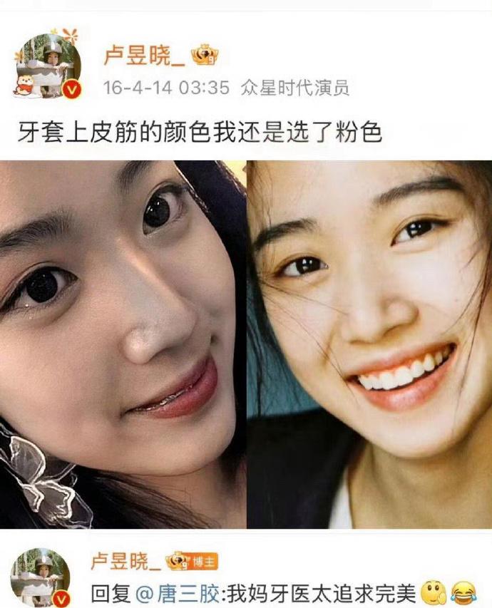 不懂就问，江浙沪独生女都这么注重牙齿矫正的吗？ ​​​