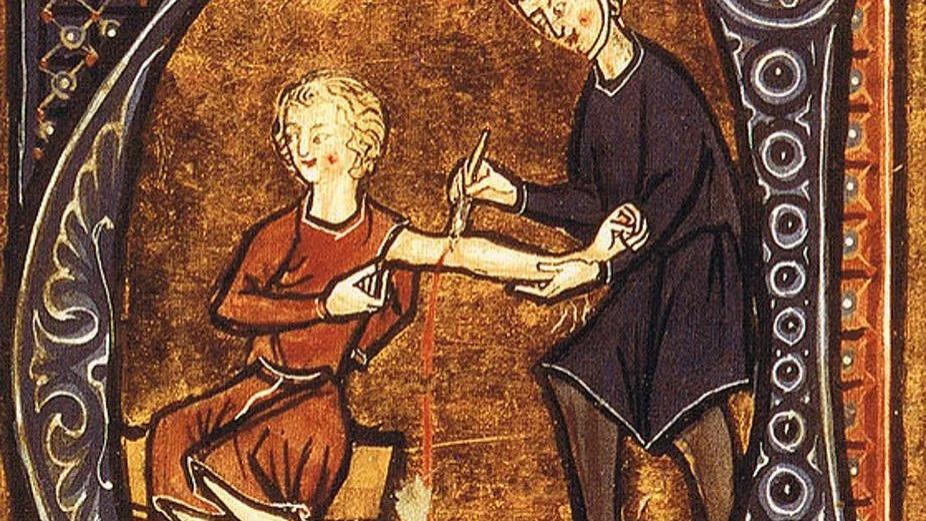 没有麻药还要被烫伤，中世纪手术太残忍