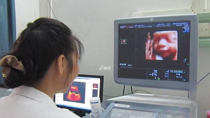 四维正面鼻大嘴大是男宝吗？不信就看一看过来人分享的参照图