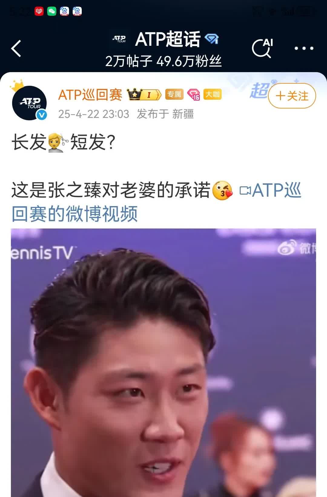 张之臻剪短发是应妻子要求！

张之臻接受采访的时候说，自己剪短发是应妻子的要