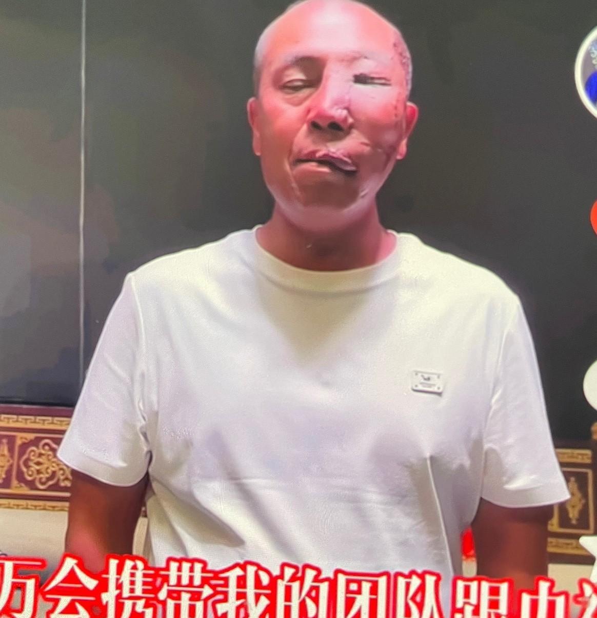 安万还是牛！13号下午6:30又将连麦央视文艺进行直播，这是何等的给力！
安万秦