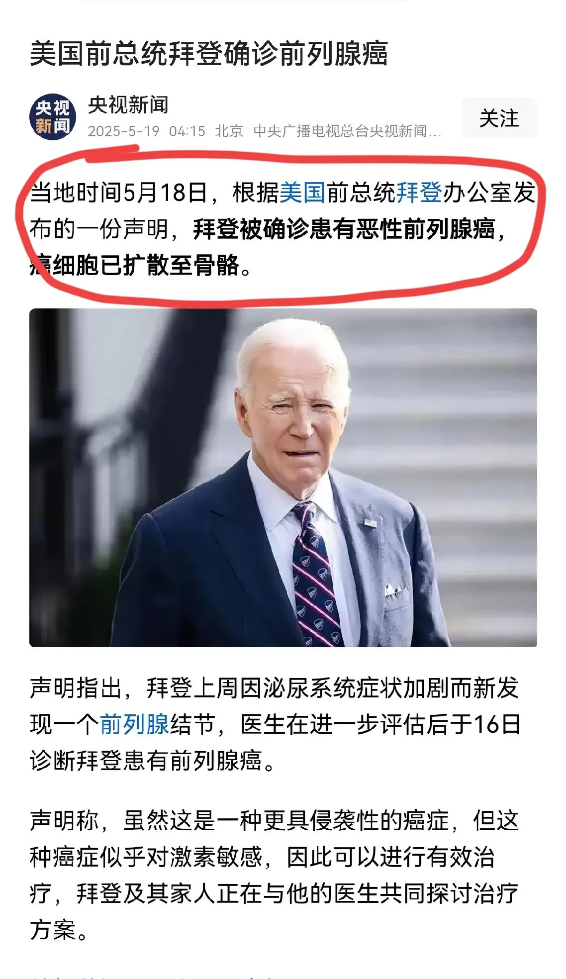 拜登查出癌症，已经扩散到骨头了











天呐！拜登竟然得了癌症，还