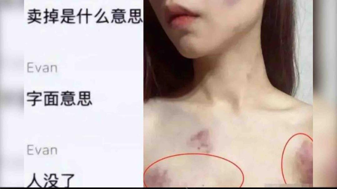 罗大美案最新动态！余某生称200万元是赠予，勒脖子也是自己臆想