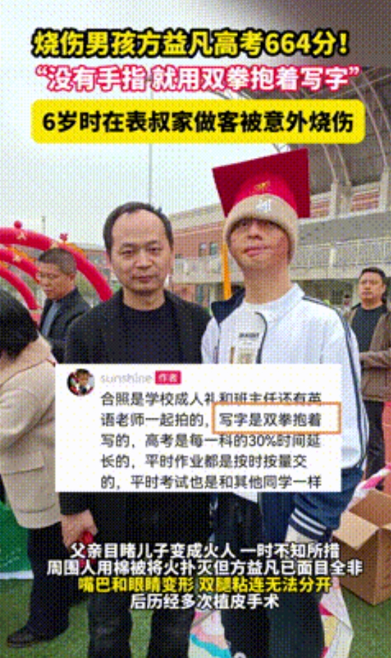 “妈妈要你好好活！”池州，烧伤男孩高考664分，全省排名1475！只因6岁那年被
