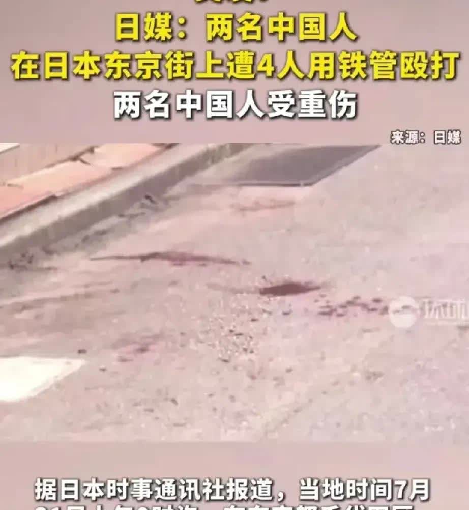 日本人在中国发生点什么事，国内媒体和大V就一窝蜂地炒作，把国人说得一文不值，而这