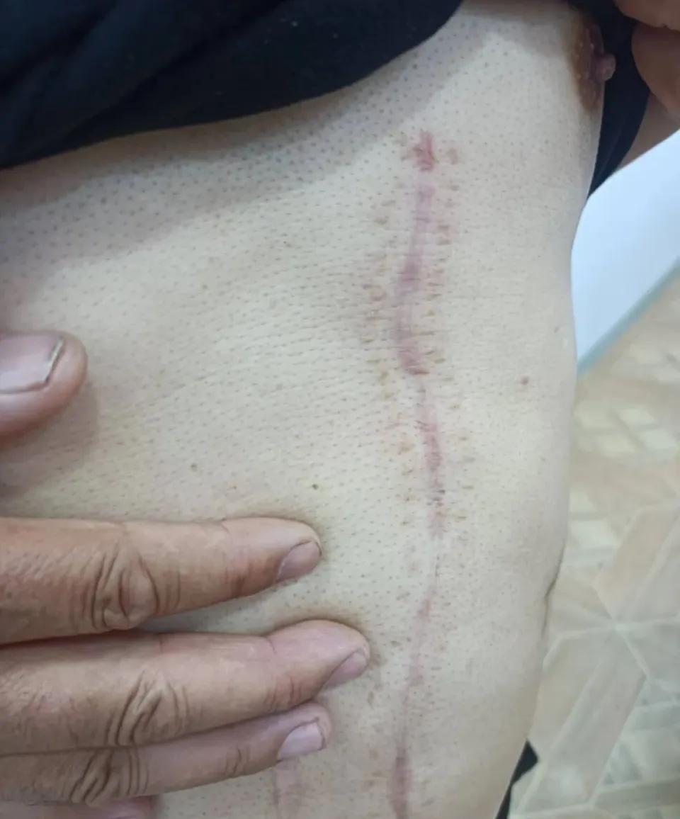 "上医院杀人来了！"河南，75岁大爷因腿疼住院儿子陪床，不料半夜同病房男子，忽然