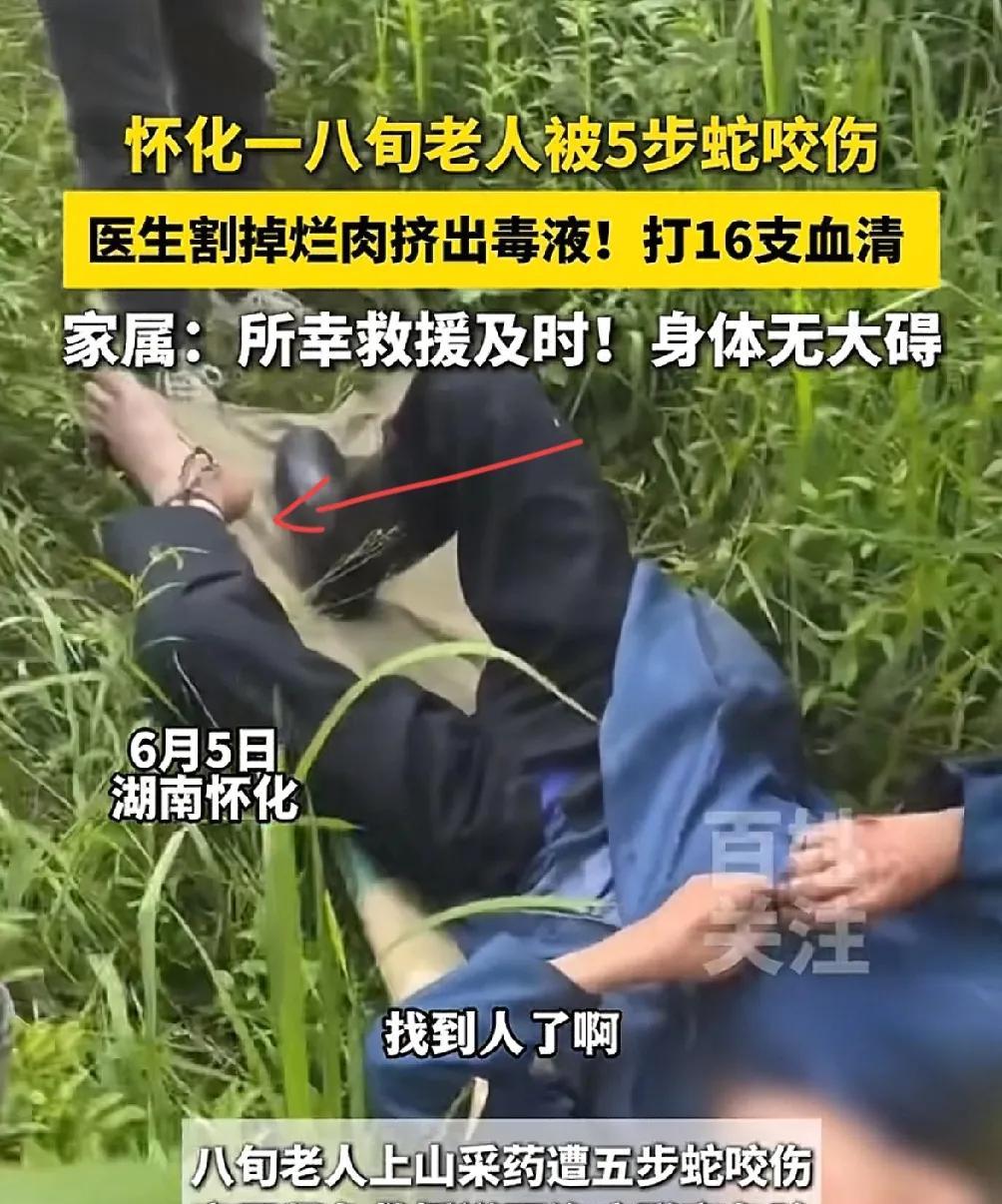 80岁老人被五步蛇咬伤，用了16支血清救回一条命 
这位老人刚刚年满80岁，上山