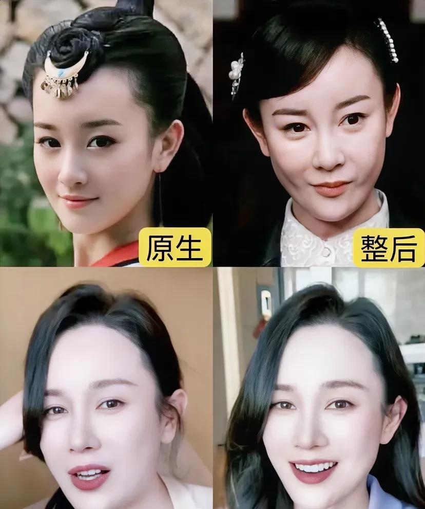 张檬，对不起，是我误会你了！
我本来以为你去整容是为了满足女人爱美的虚荣心。万万