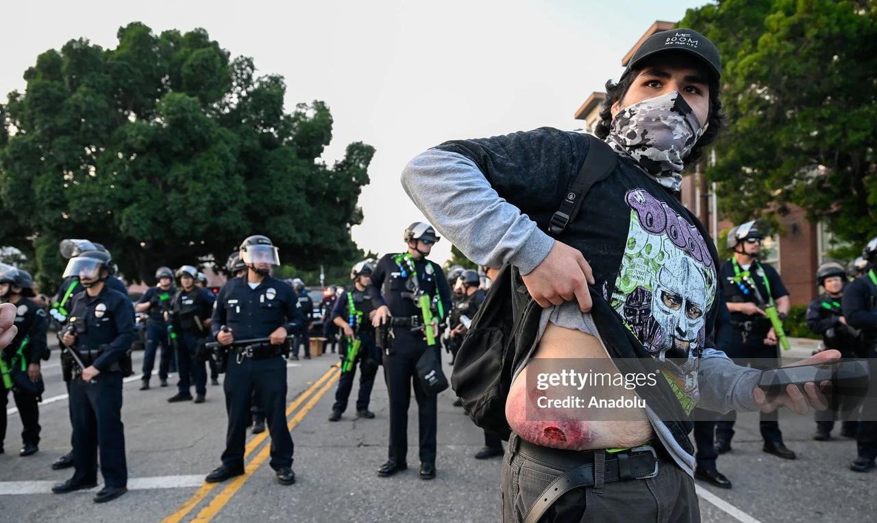 美国洛杉矶街头，一名抗议者在警方防线前展示自己腹部的伤口。