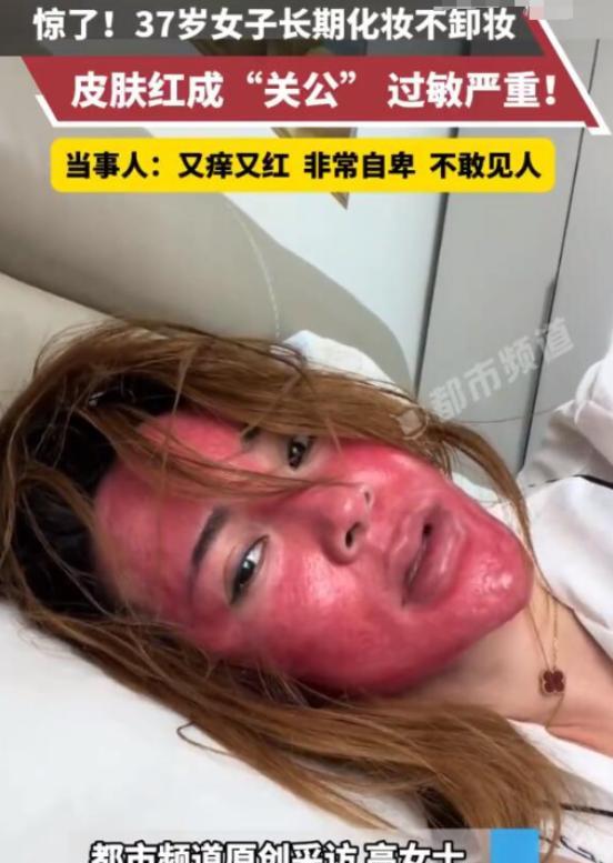 吉林37岁女子从15岁开始化妆，就没有卸过妆。好不容易勤奋一次，心血来潮卸了个妆