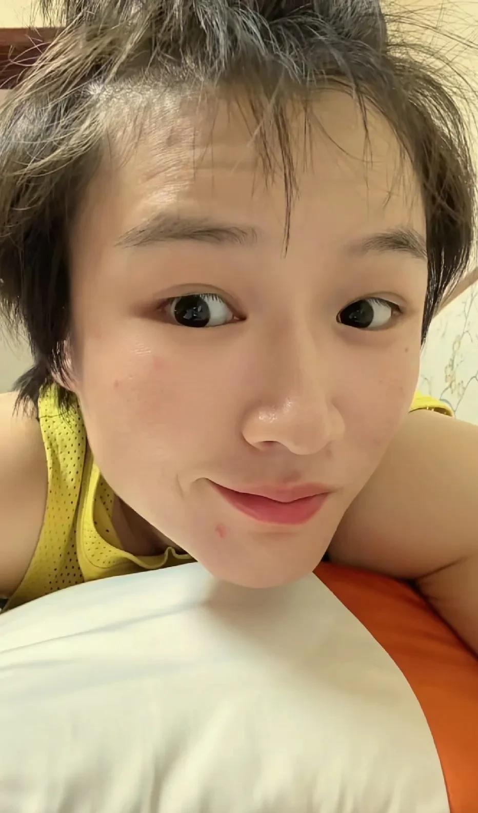 我的女神丽丽上啥火了啊，脸上咋起痘了呢？