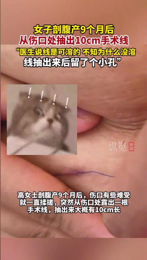 “吓坏了！”云南大理，女子剖腹产9个月后，伤口处总是出现阵阵的微痛感，她不停的揉
