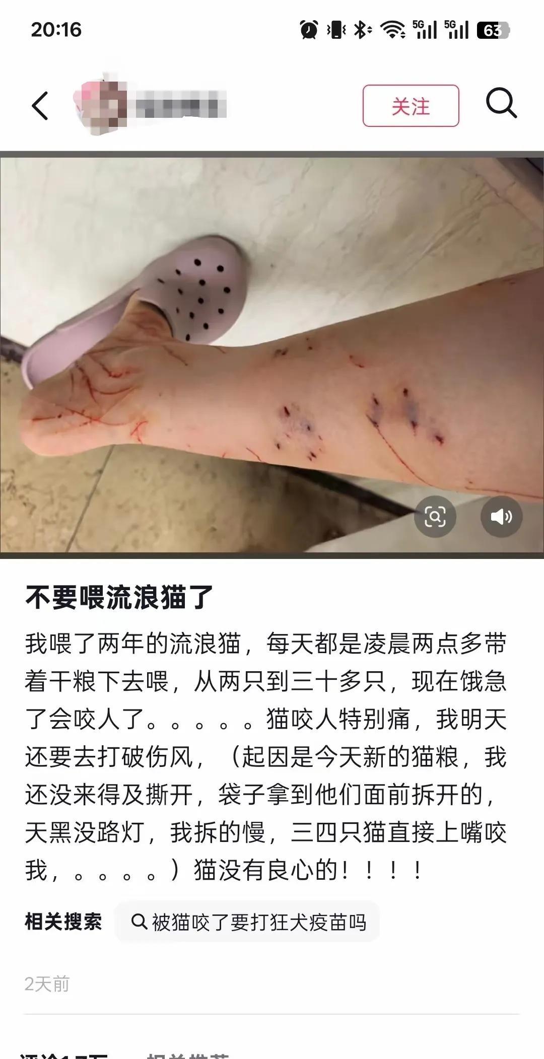 喂流浪猫被猫咬伤，痛的大叫再也不喂了。
一个爱猫人士投喂流浪猫，因为猫粮袋子拆开