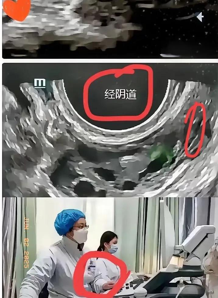 苏州这事儿，简直震碎三观！
被质问时，医生轻飘飘一句“阴超更贵”，连句道歉都没有