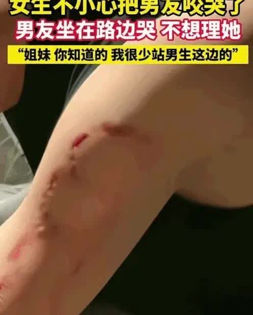 女子和男朋友约会，本来是挽着男朋友的胳膊，有说有笑的，女子却突然咬男友胳膊，男友