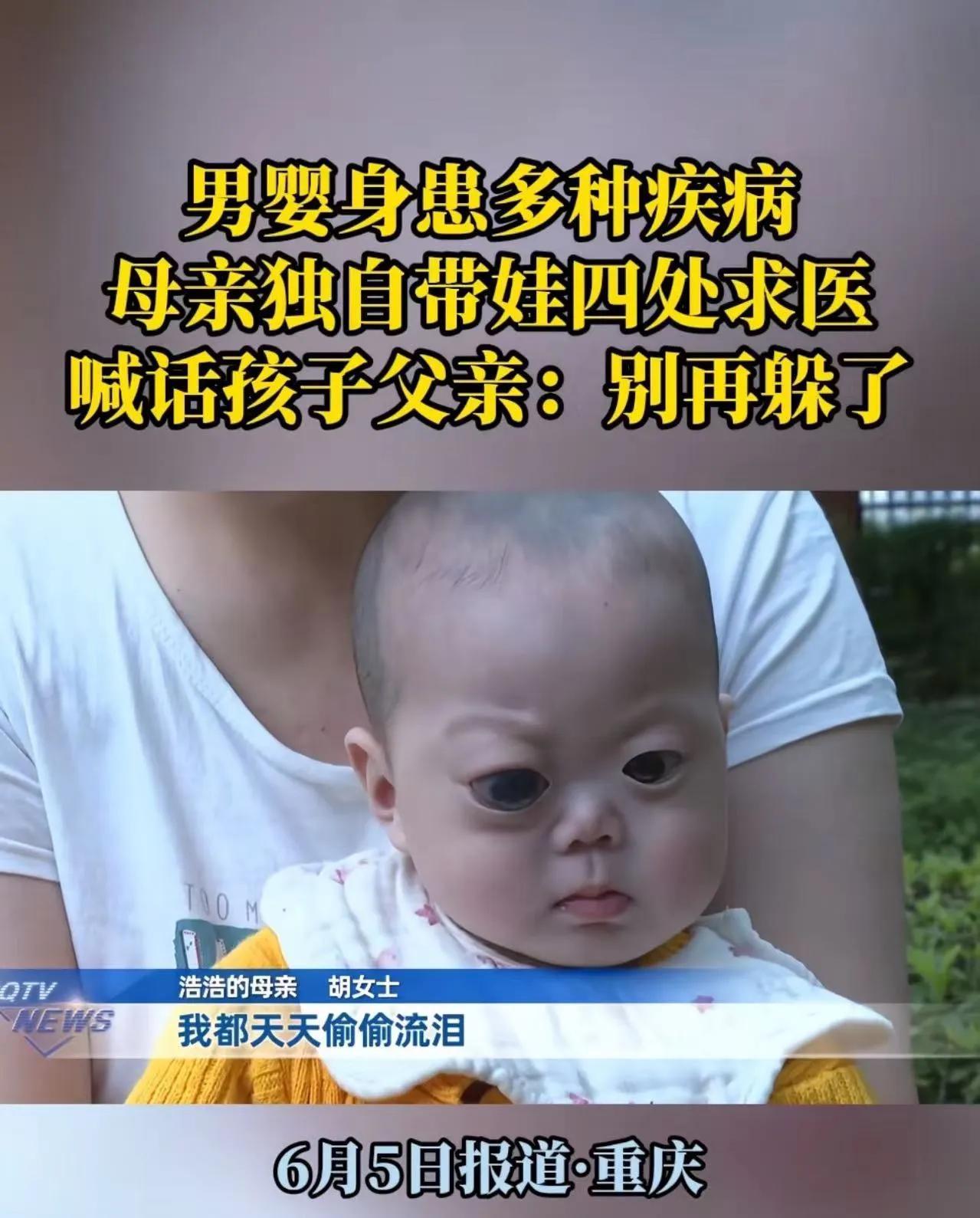 女子生的孩子被人说长得像怪物，丈夫劝她放弃治疗，不要让这个孩子拖累家庭。但女子不