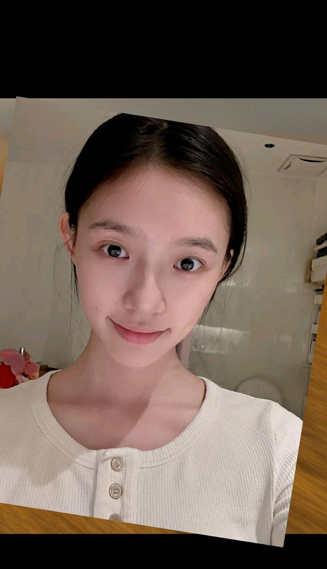 真是可惜了，林允已经走上了医美的不归路。
总是发一些医美后的照片。
到底想做什么