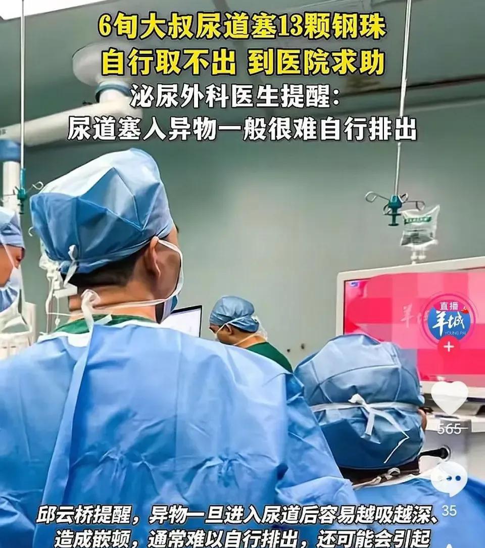 最近广州一位大叔可真是“玩出火”了！为了寻求刺激，他竟把13颗磁力钢珠塞进尿道，