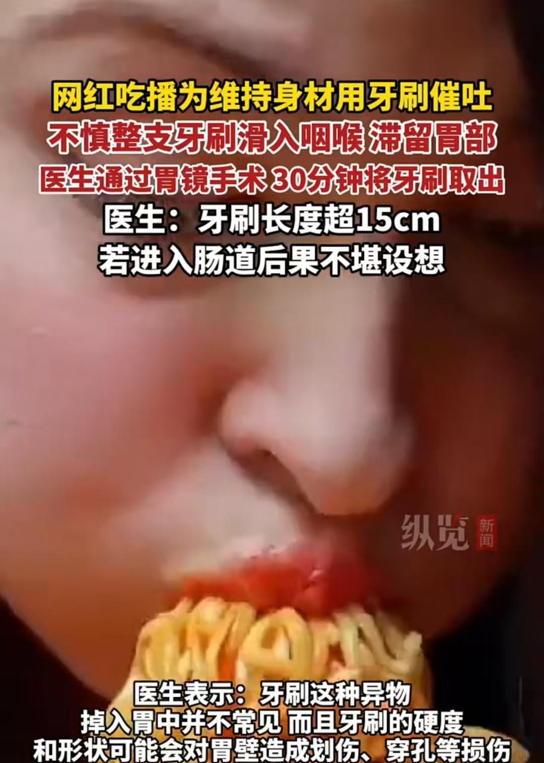 浙江，一名网红吃播为了维持身材，用15厘米长的牙刷刺激喉咙催吐。结果，整支牙刷掉
