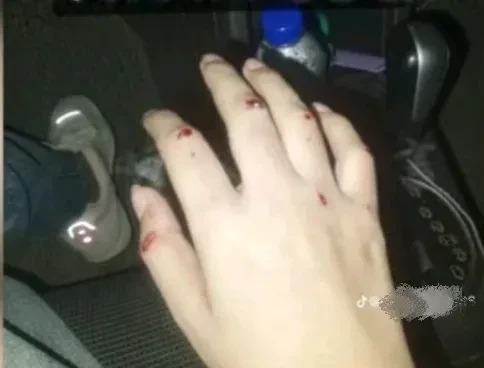 阿霞回巴铁后，咋混成这样了？











天呐！阿霞这是咋了？想当年在