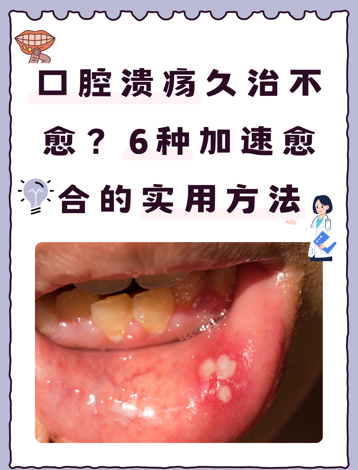 口腔溃疡久治不愈？6种加速愈合的实用方法

　　口腔溃疡是一种常见的口腔黏膜