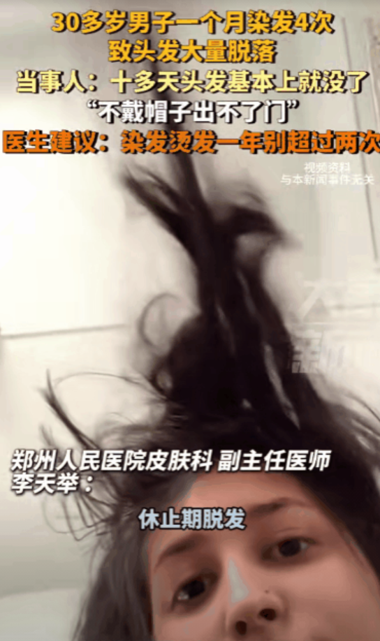 太惨了！河南郑州一名 30 多岁的男子，为追求时尚一个月内染发 4 次，结果等来