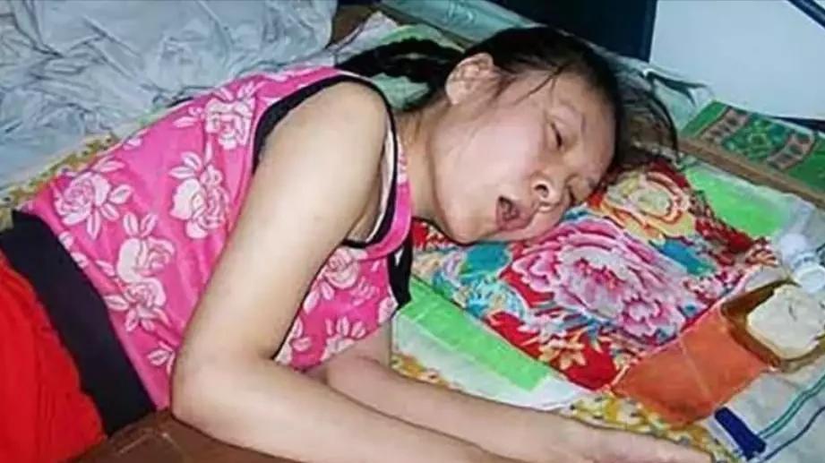 2003年，亲哥扇了她俩耳光，她趁机装瘫了。这一瘫就瘫了20年！真是装瘫界的翘楚