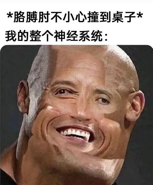是这样没错