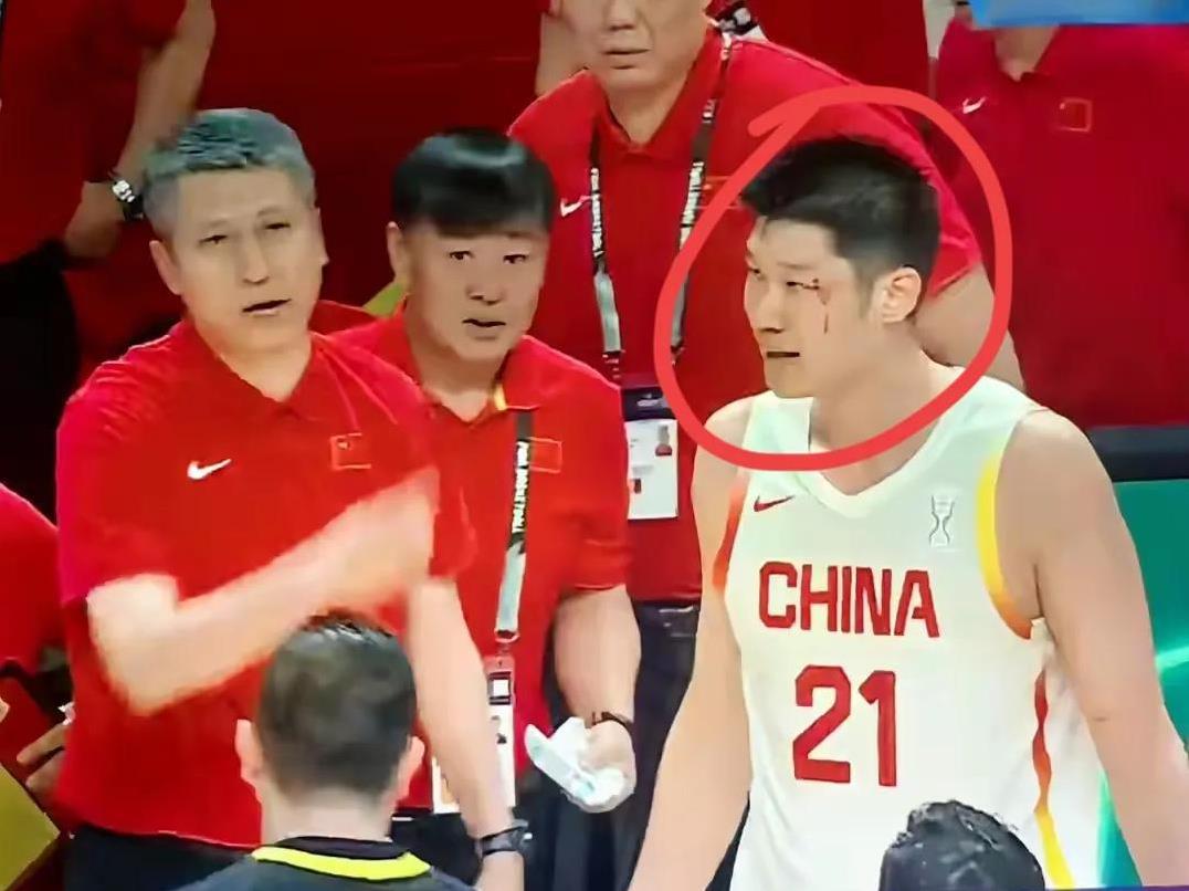 心疼胡金秋！
胡金秋左眼角挂彩，赛后面对记者采访时，他说:“这没事，都是小事，对