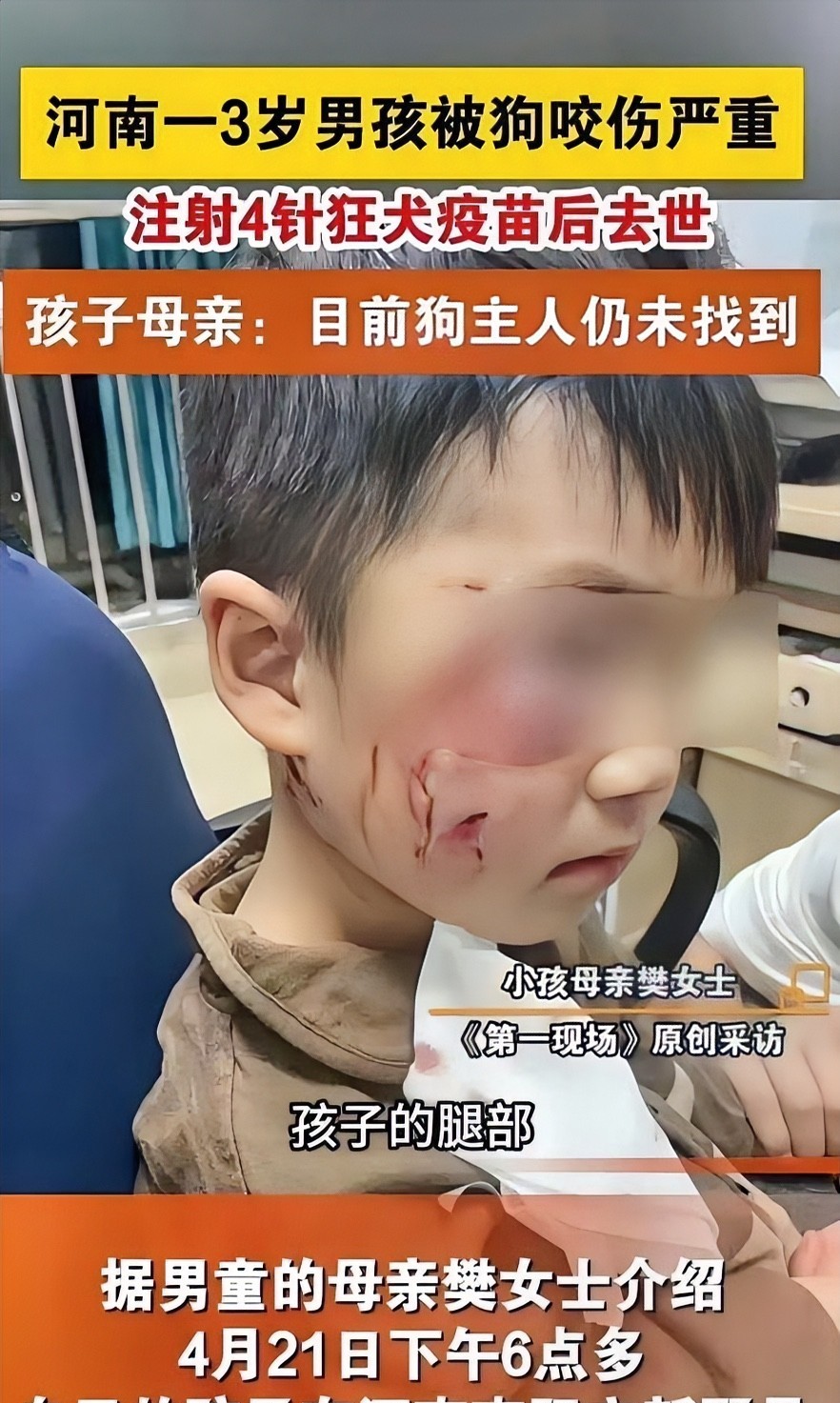 4月21日，河南南阳市新野县一三岁幼童被狗咬伤，打4针狂犬疫苗仍然去世，但是至今