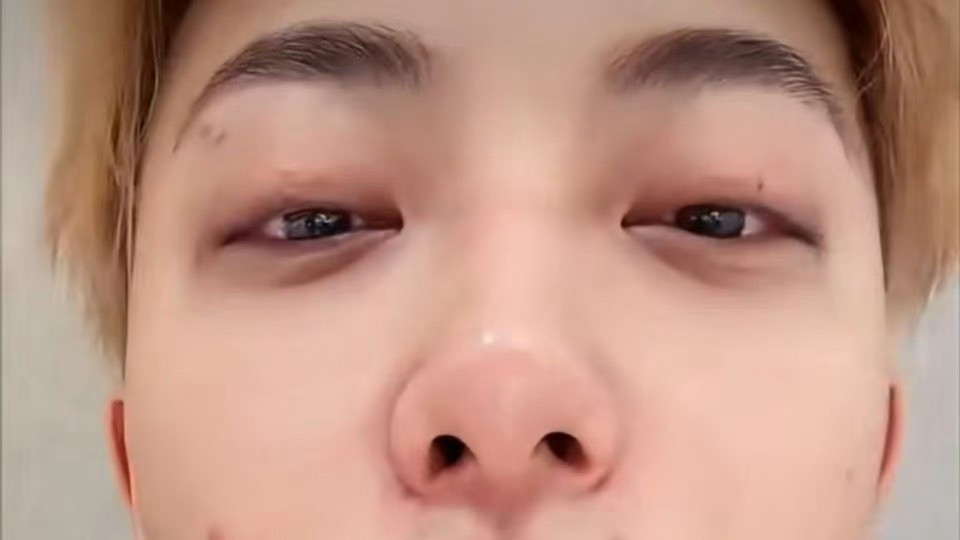 黄子韬直播数痘，这波操作太“上头”！