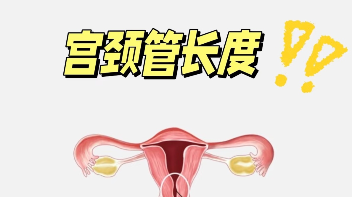 宫颈管短了，我的宝宝还安全吗？