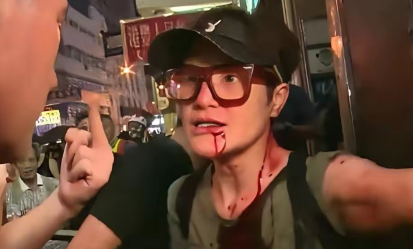 这事儿真是越想越憋屈！TVB那个经常演丑角的马蹄露，最近发公开信硬刚张敬轩了。
