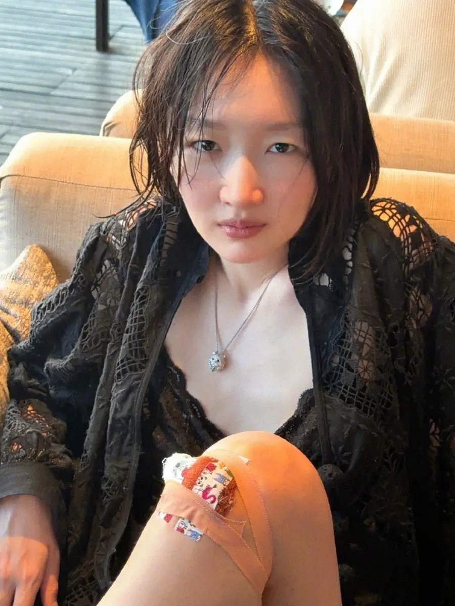 周冬雨晒海边度假美照少女感十足，膝盖被包扎疑似受伤