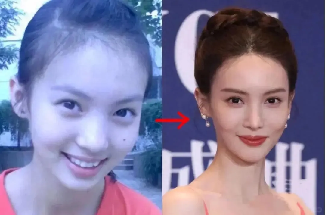 金晨“车祸顶包案”二次发酵！

之前声称因救狗受伤的金晨，再次卷入争议漩涡。狗仔