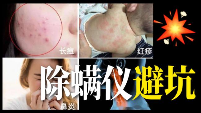 家庭有必要买除螨仪吗？除螨仪器真的有效吗还是忽悠？全网畅销的品牌10大排行榜最新推荐！