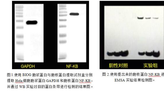 EMSA实验核心要素之胞浆与胞核蛋白提取的重要性及试剂选择