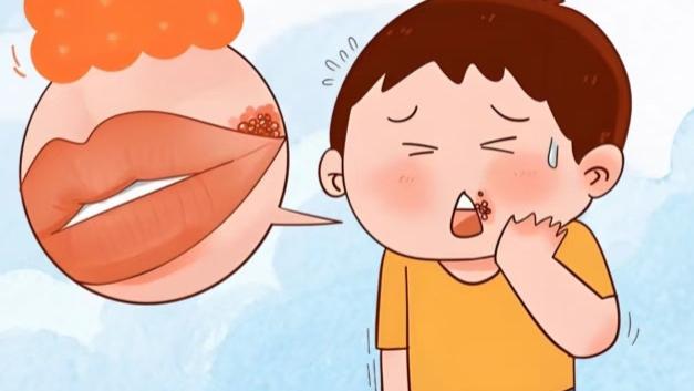 破解宝宝“烂嘴角”魔咒：5个元凶+4步护理法，这个冬天不再愁