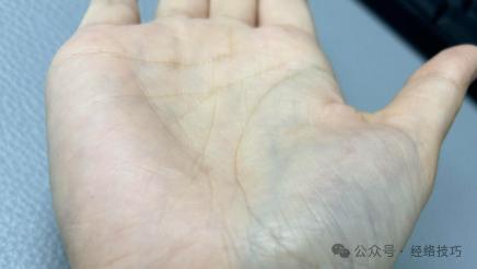 看这一个部位，可大概知五脏情况