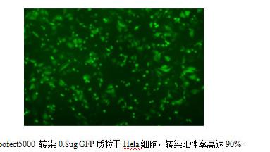 如何选择质粒DNA转染试剂？