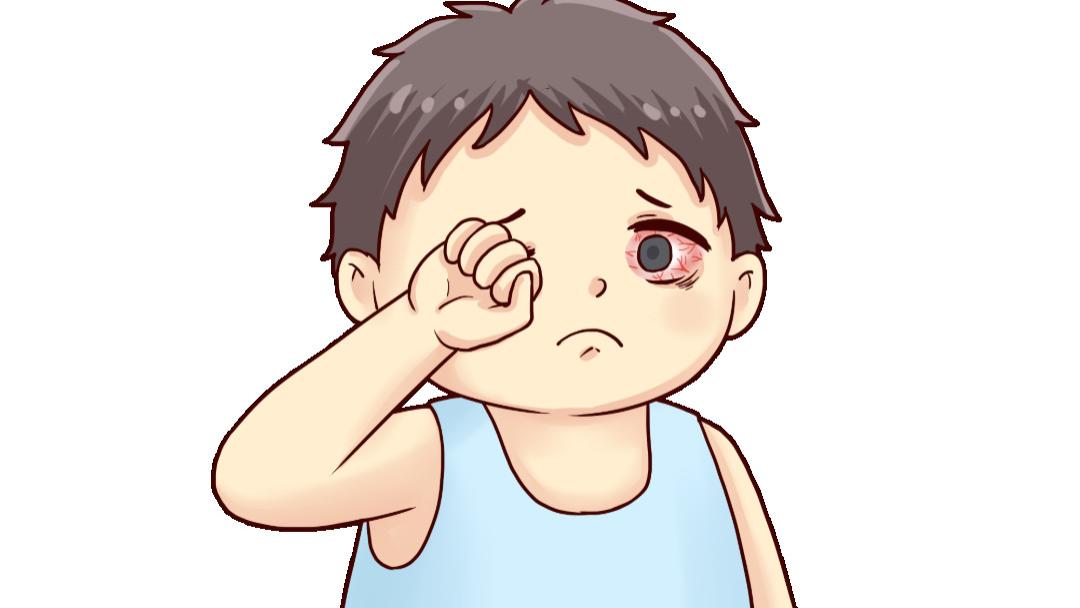 睡够8小时，眼睛还是布满红血丝？