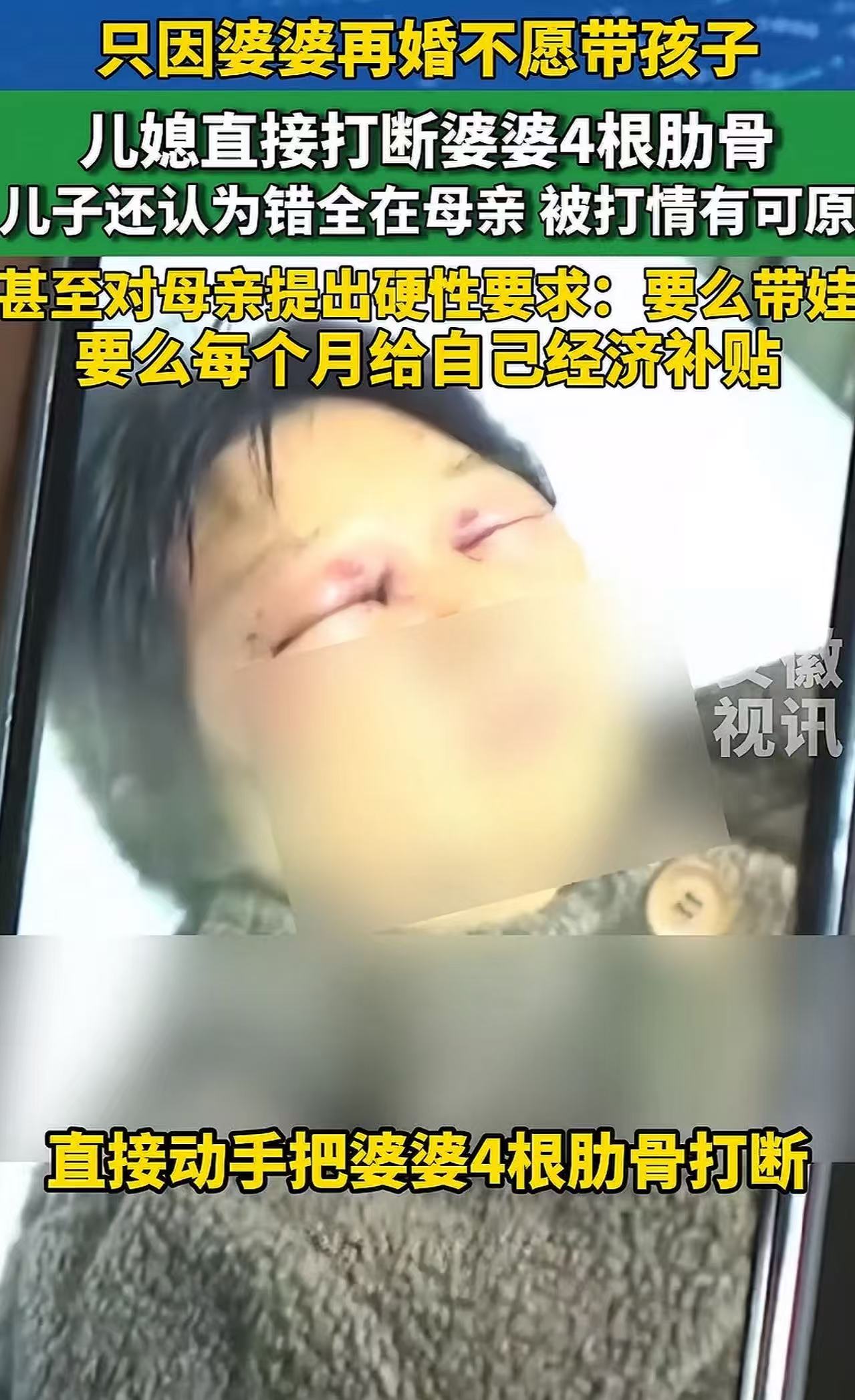 活久见！只因婆婆再婚不愿带孩子，儿媳直接打断婆婆四根肋骨，儿子还认为错全在母亲，