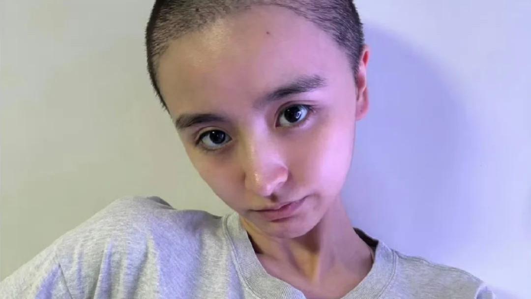 金子涵直播疑似求救：脸部被注射50针不明物质，不服从便会头痛