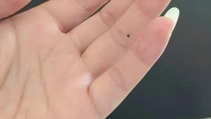 左手无名指长痣另一半事业大成