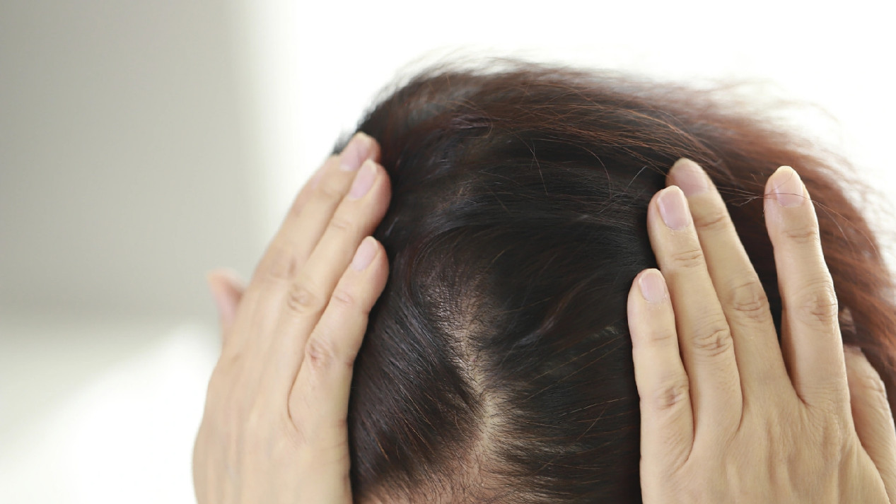 卡诗头皮精华好吗？拾宓vs OffRelax实测，油头3天不塌秘诀