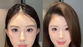 头屑反复、头皮痒、还断发？我的头皮护理日常心得